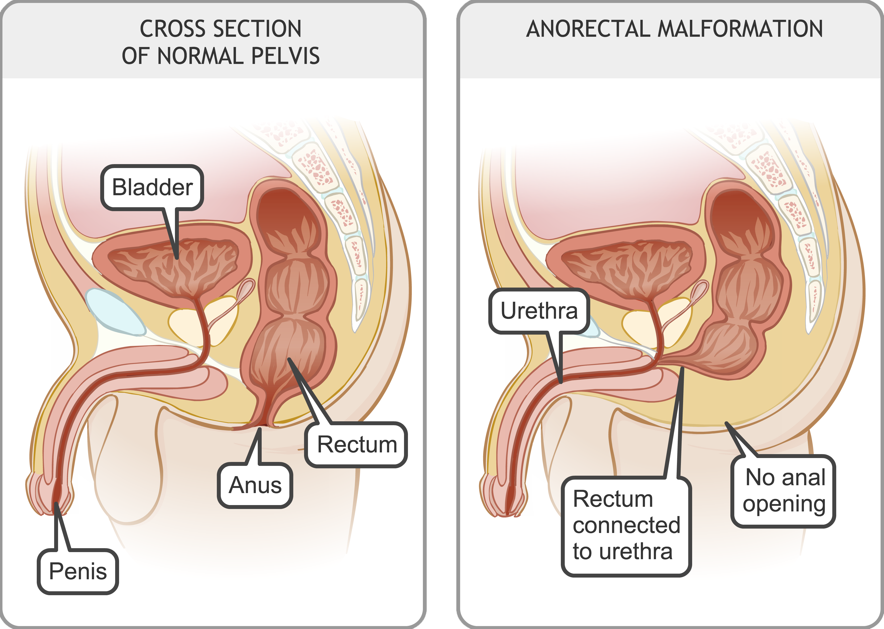 Black L. reccomend anus rectum diagram